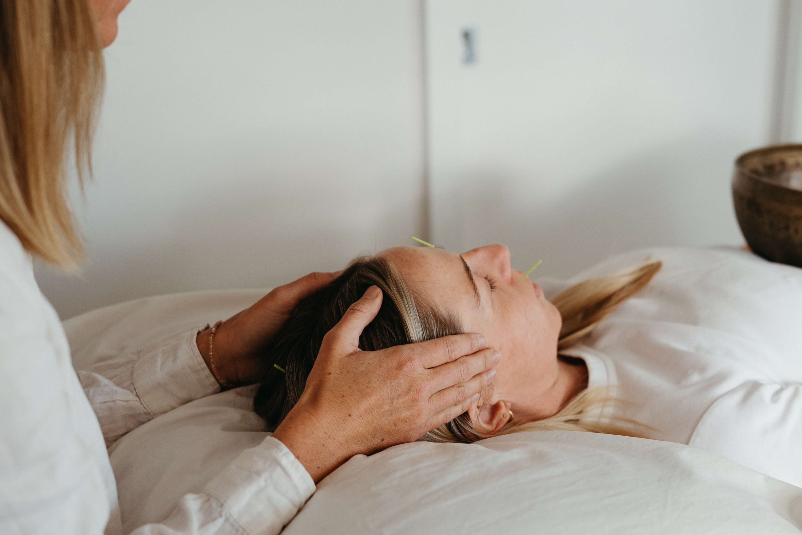 Cosmetic Acupuncture in Cromer, Northern Beaches
