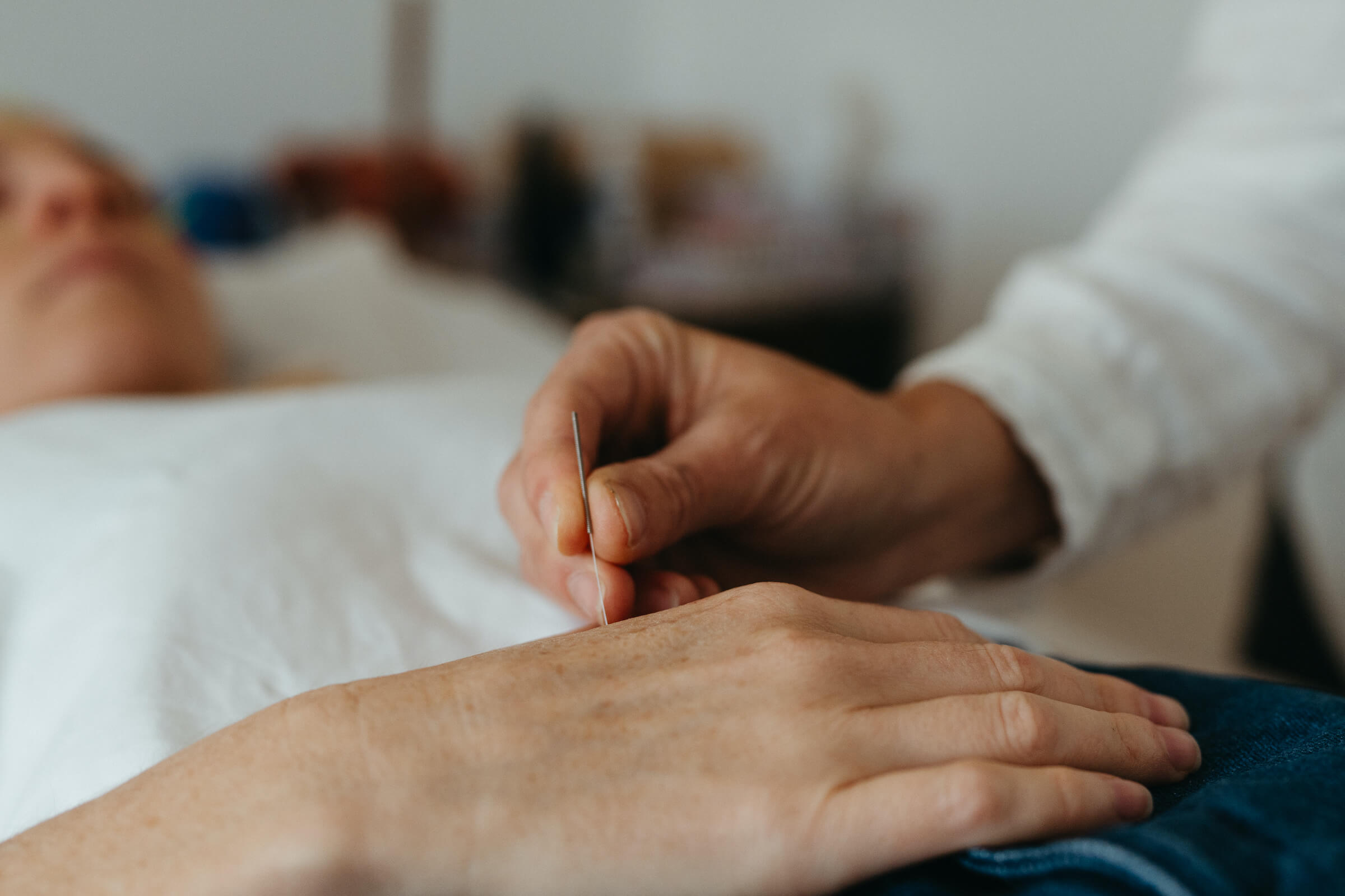 Wellbeing Acupuncture for Mental/Emotional Health | Cromer, Northern Beaches